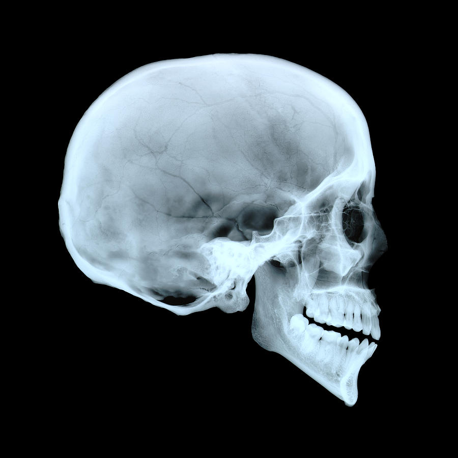 adult-human-skull-d-roberts.jpg